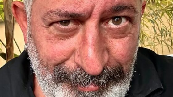 Cem Yılmaz’a anjiyo yapılıyor
