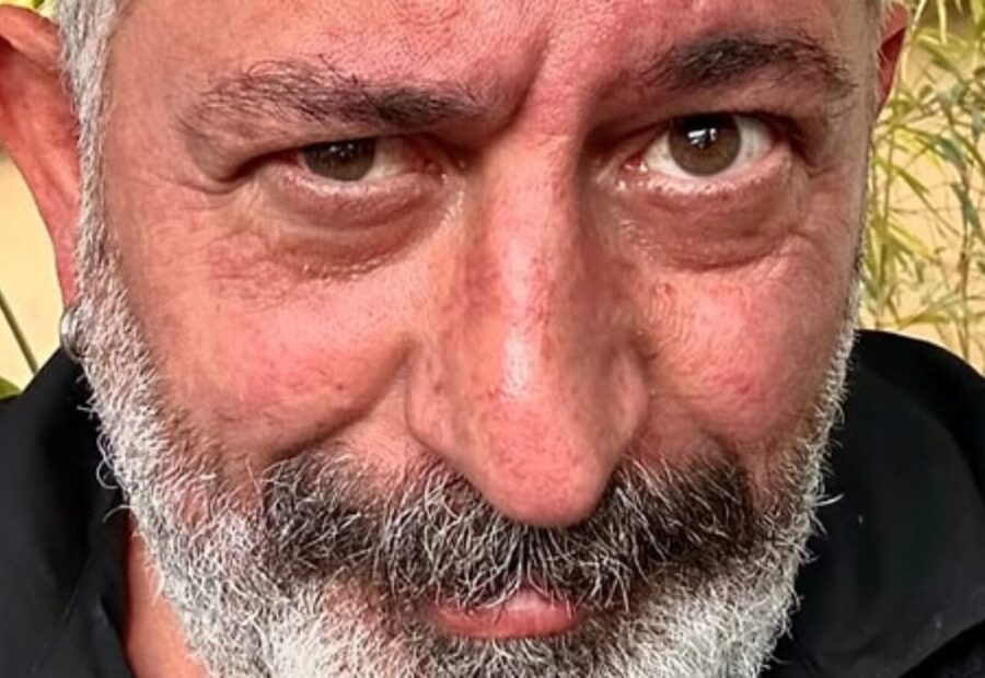Cem Yılmaz’a anjiyo yapılıyor