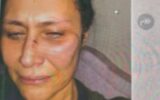 Neslihan Acar: Levent şiddeti İstediği kadar inkâr etsin, olayı bilen o kadar şahit ne olacak?