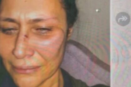 Neslihan Acar: Levent şiddeti İstediği kadar inkâr etsin, olayı bilen o kadar şahit ne olacak?
