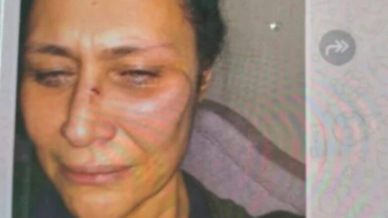 Neslihan Acar: Levent şiddeti İstediği kadar inkâr etsin, olayı bilen o kadar şahit ne olacak?